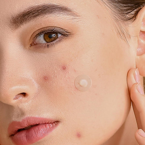 Glow in the Dark Hydrocolloid Acne Patches